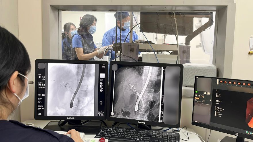 7. ERCP 사진(전효근 과장).jpg